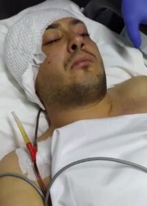 Uzman çavuşun inanılmaz kurtuluşu! İlk sözleri duygulandırdı 11 Bülten Medya -