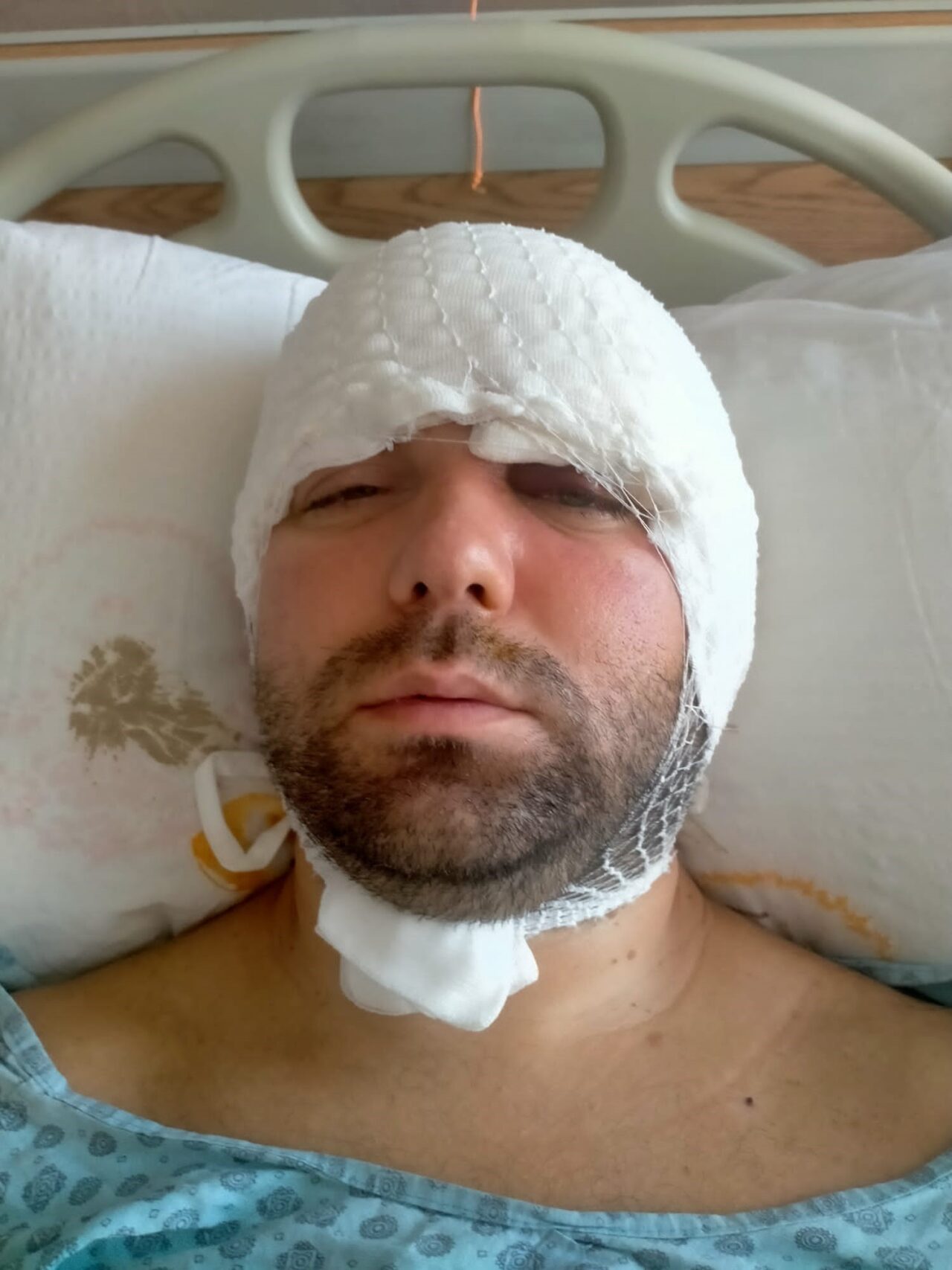 Bursa'da dişini çektirdi ölümden döndü! 2 Bülten Medya -