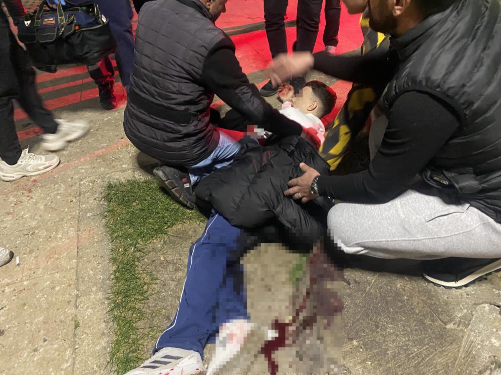 Parkta bıçaklı kavga 1 Bülten Medya -