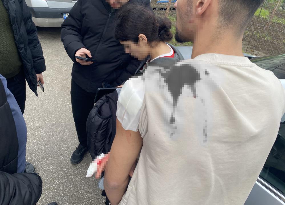 Bir anda büyüdü… kız meselesi kanlı bitti 1 Bülten Medya -